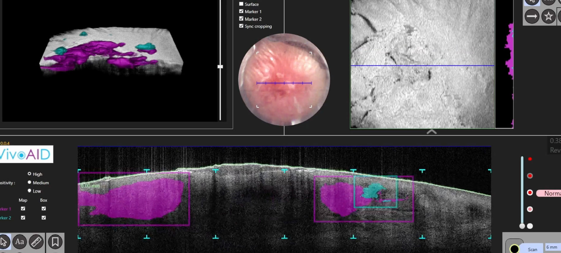 Non-invasive OCT scan provides high resolution images through the skin