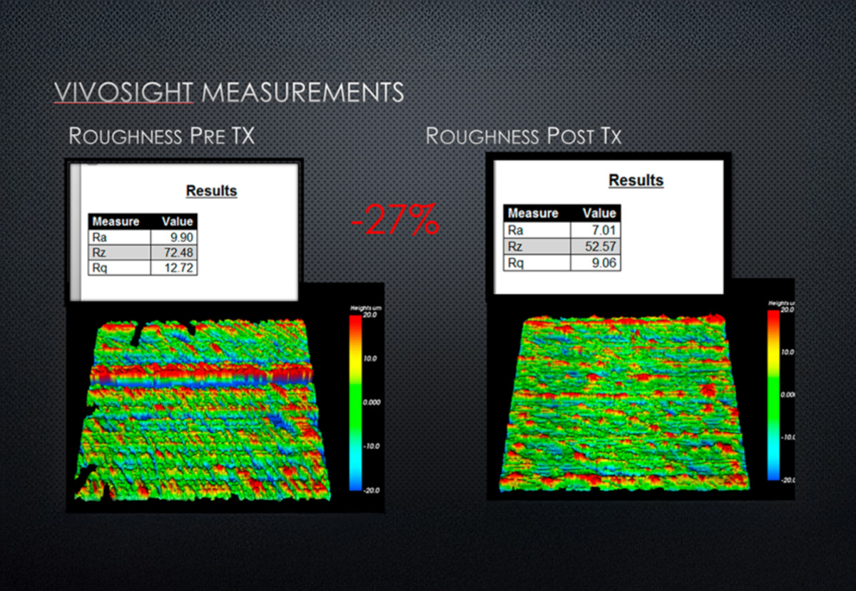 Automated skin roughness analysis with VivoTools